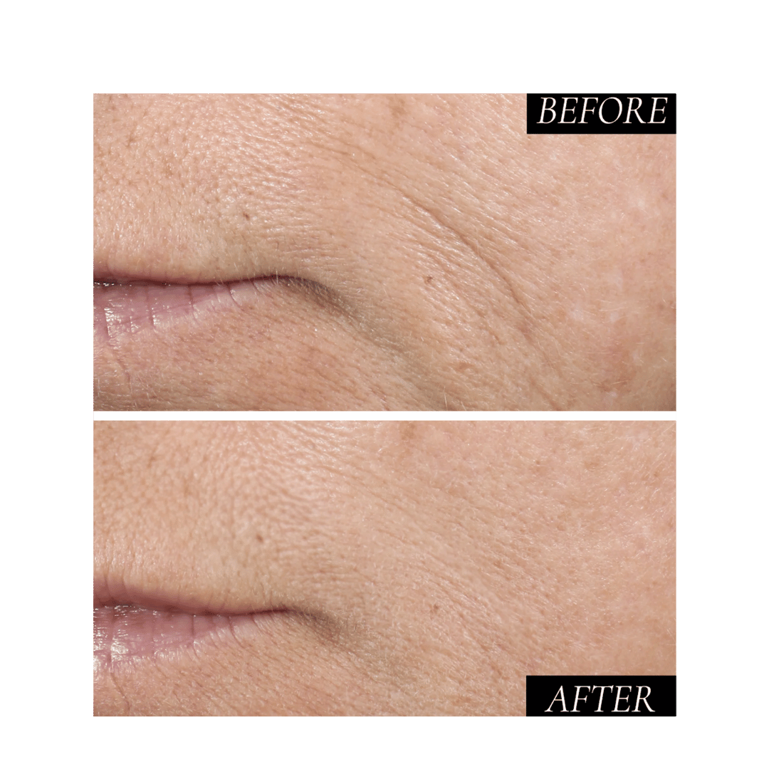 Kaplan MD Diamond Contour Daily Facial 40ml