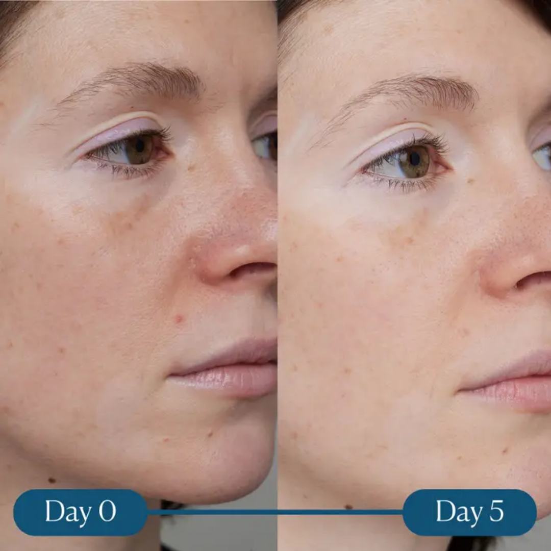 Elemis Dynamic Resurfacing Super-C Serum 15ml